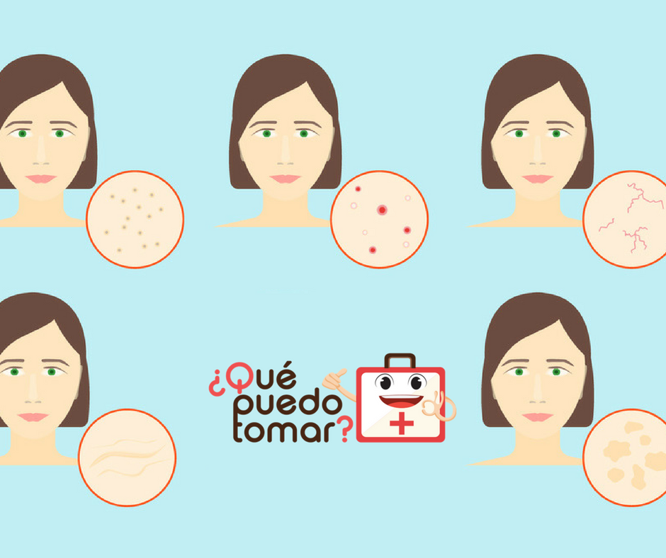 Dermatitis en la cara