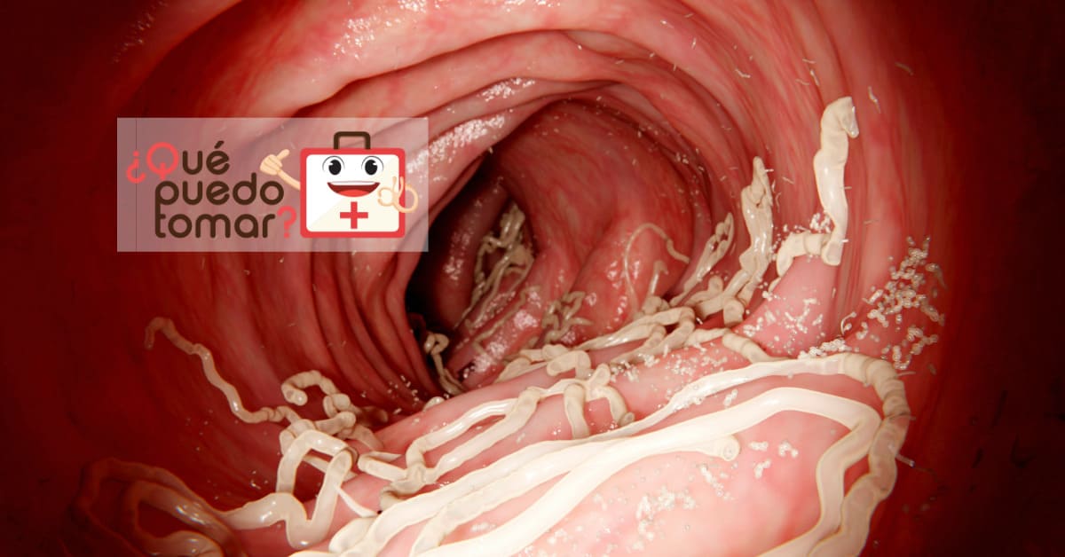 Qué puedo tomar para eliminar los parásitos intestinales